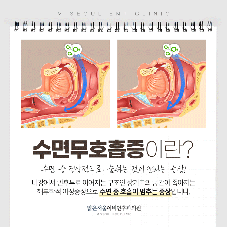 의정부수면클리닉 알맞은 치료를
