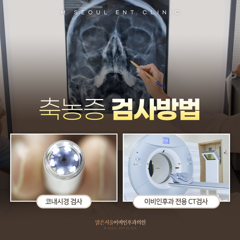 의정부축농증 방치하게 된다면