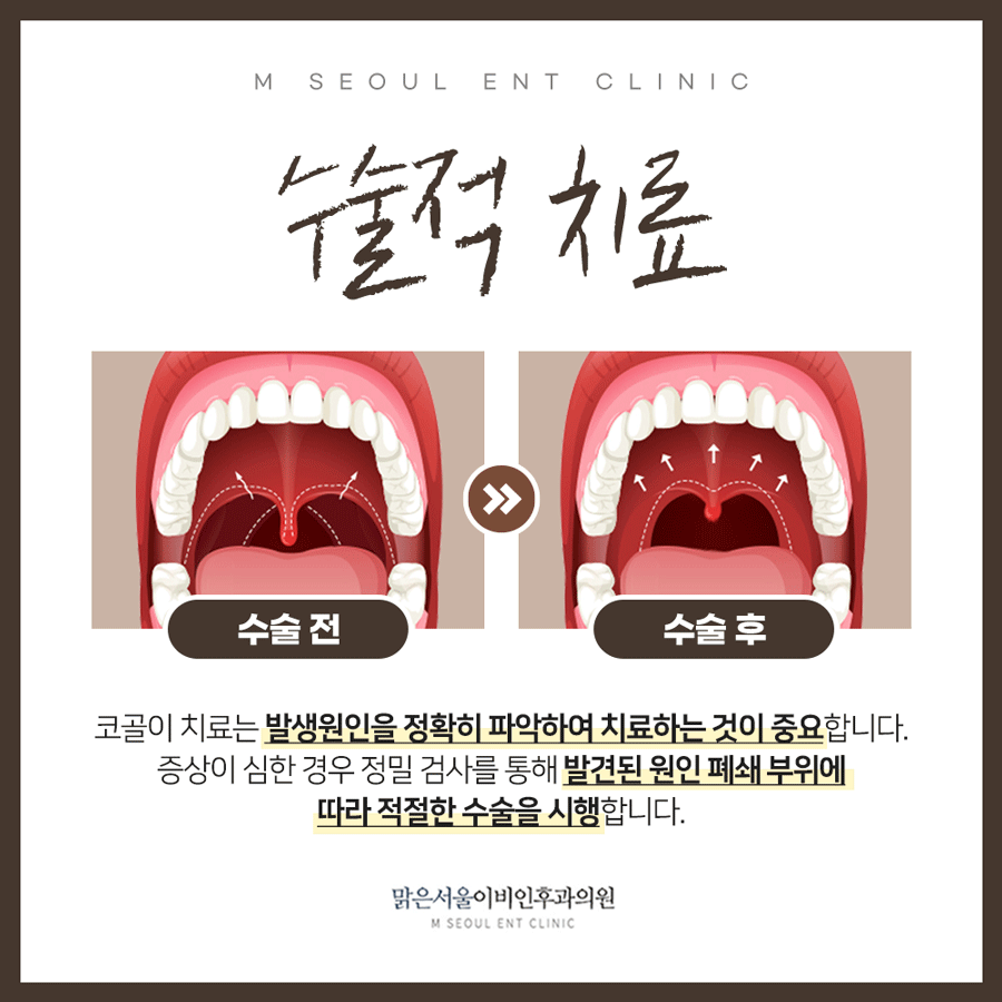 의정부수면장애 다양한 방법으로