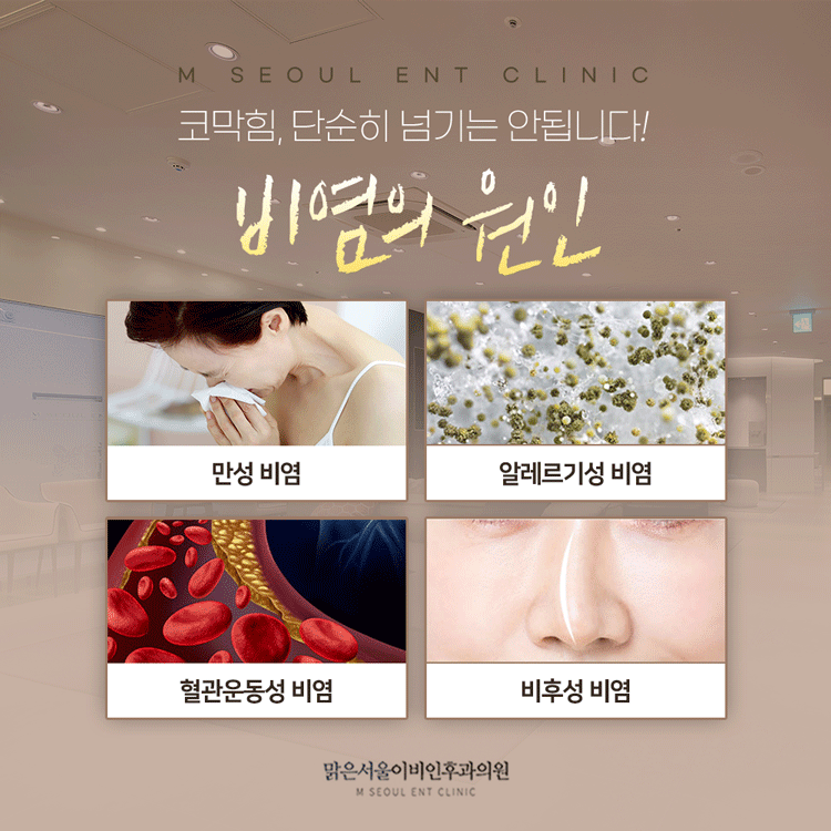 의정부비염 서서히 악화되어