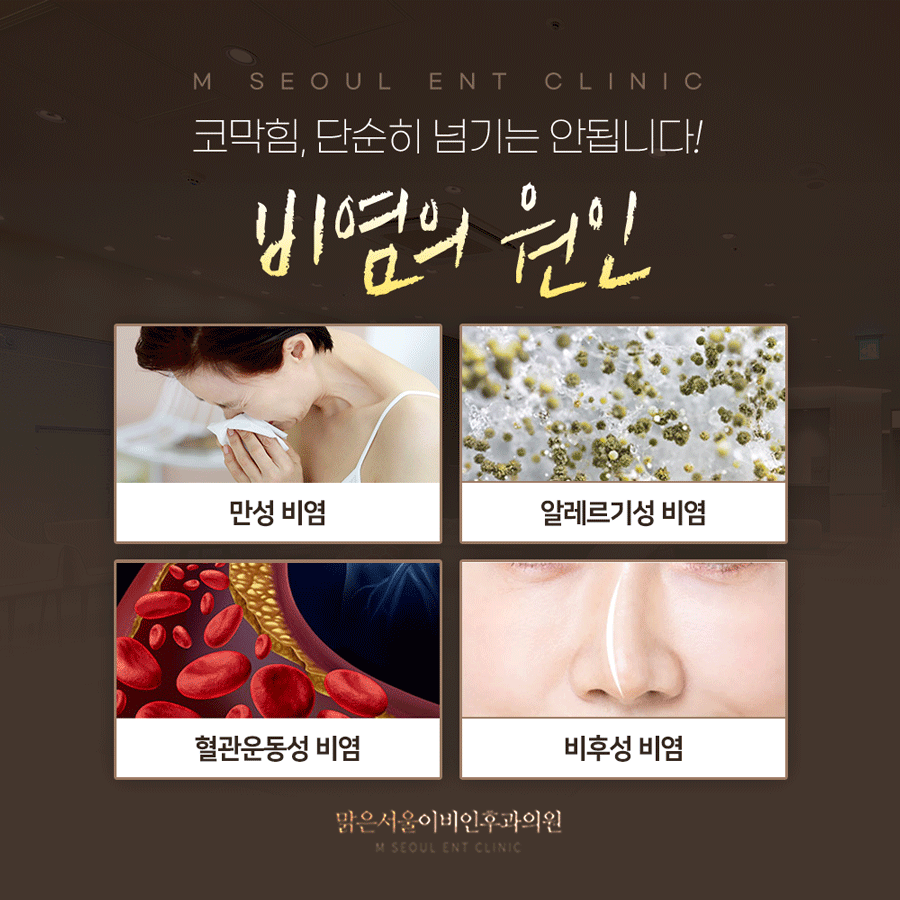 의정부비염 더해가는 증상은