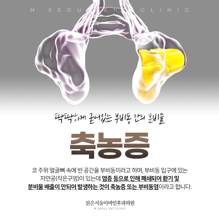 의정부부비동염 방치하지 않도록