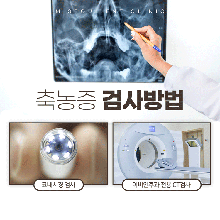 의정부부비동염 방치하지 않도록