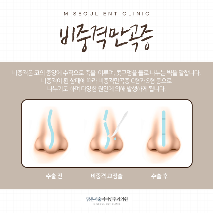 송산역이비인후과 일상의 불편함을