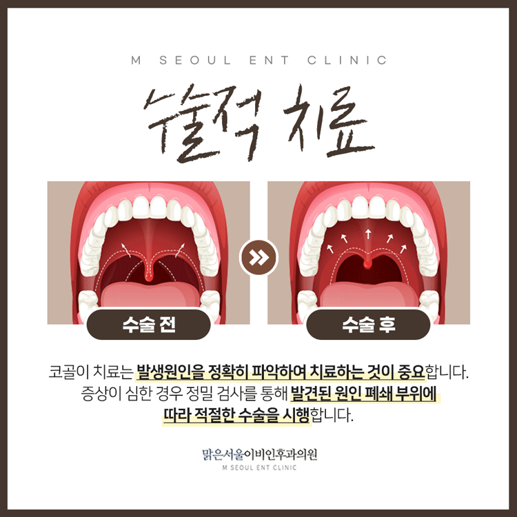 남양주수면장애 참기 힘들었다면