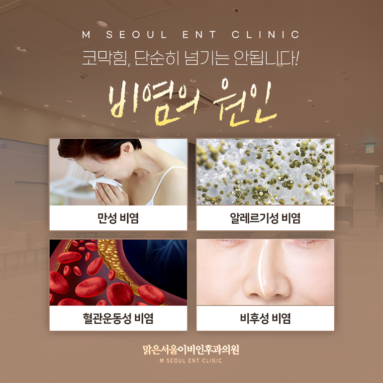 의정부비염 불편함이 뒤따라