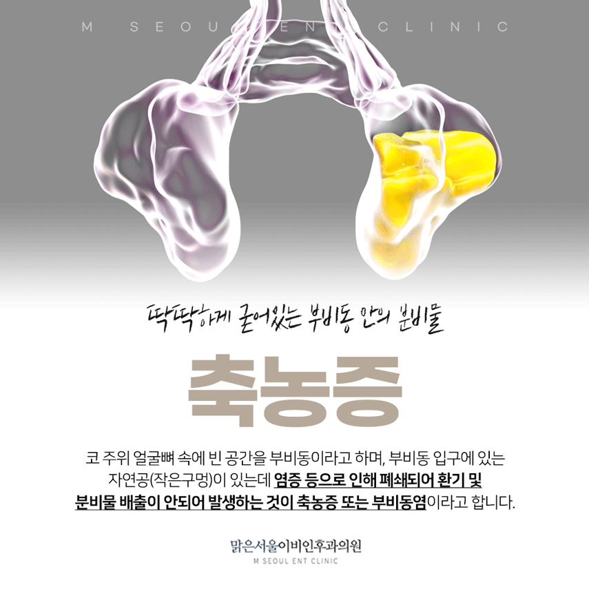 의정부축농증 심해지는 증상에