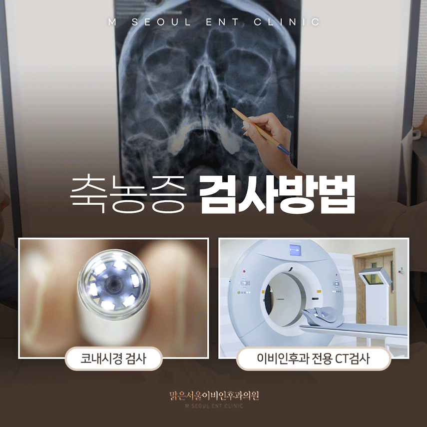 의정부축농증 심해지는 증상에
