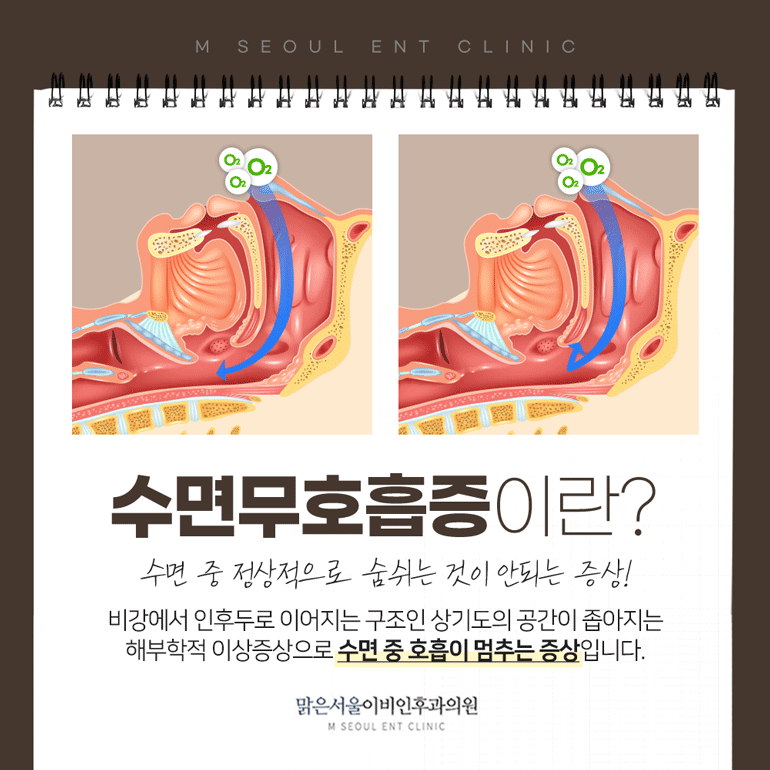 옥정이비인후과 개선이 어려웠던