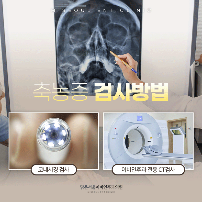남양주축농증 점점 더 심해지는