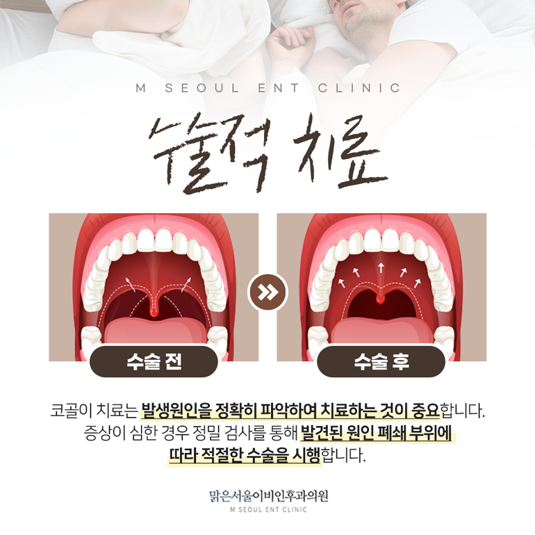 동두천이비인후과 잠에 대한 문제는