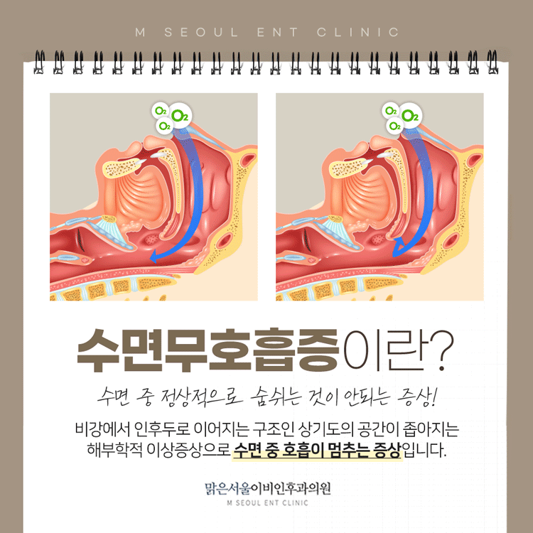 의정부수면장애 심해지는 증상에