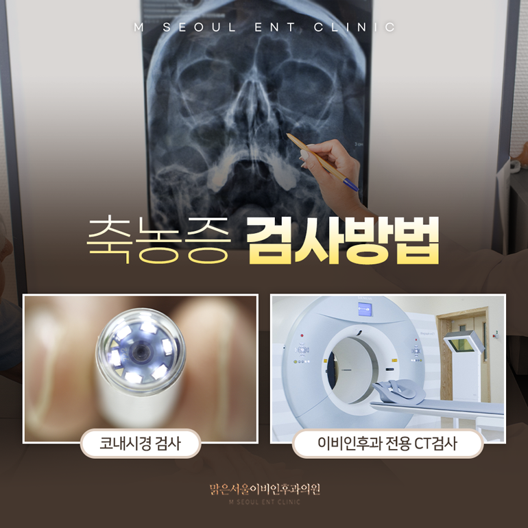 의정부축농증 계속되는 코막힘