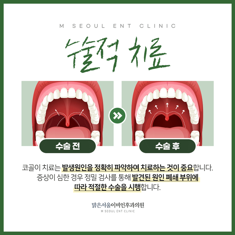 동두천코골이 쾌적한 일상을