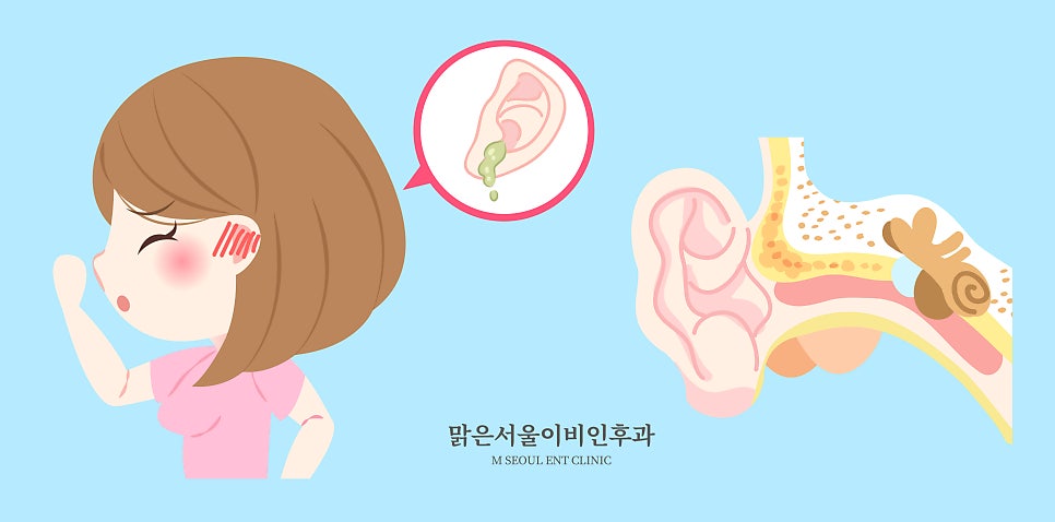 중이염 원인과 치료방법은? [민락신도시이비인후과]