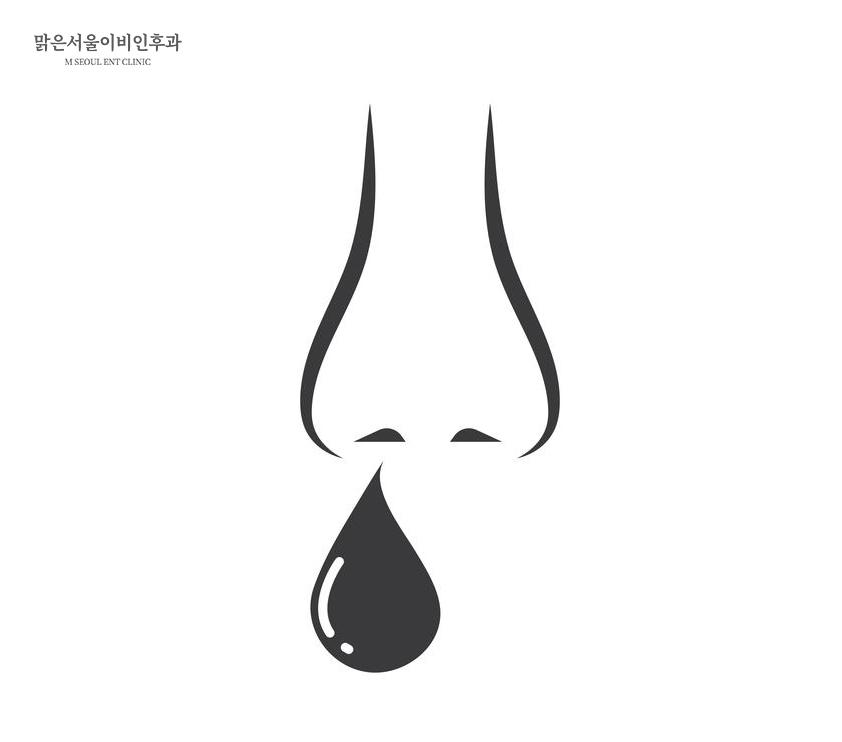 비후성비염이란? [양주이비인후과]