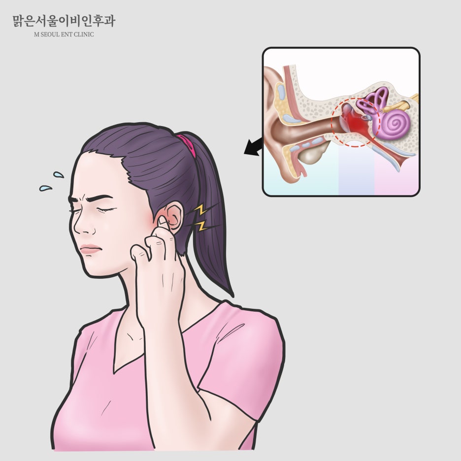 만성중이염 치료법은 [의정부이비인후과]