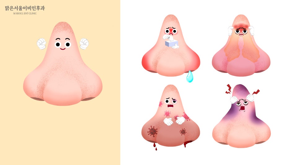 비중격만곡증 증상과 치료법은 [의정부이비인후과]