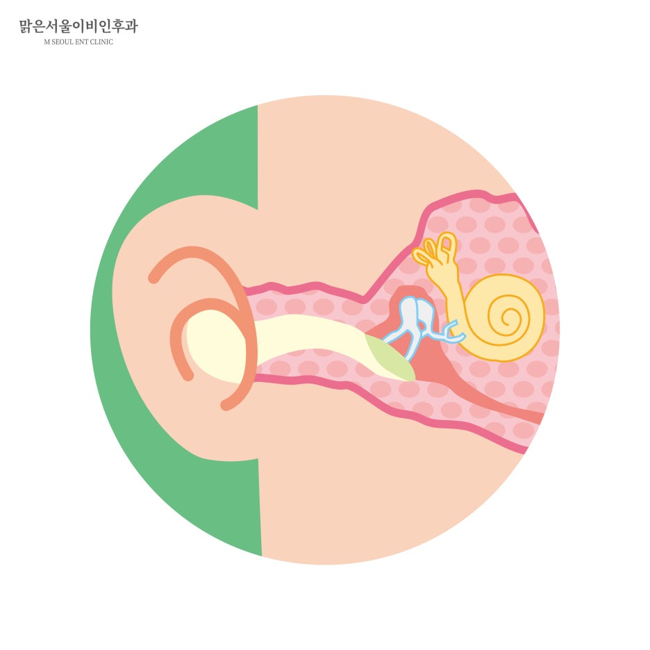 삼출성 중이염이란 [구리이비인후과]