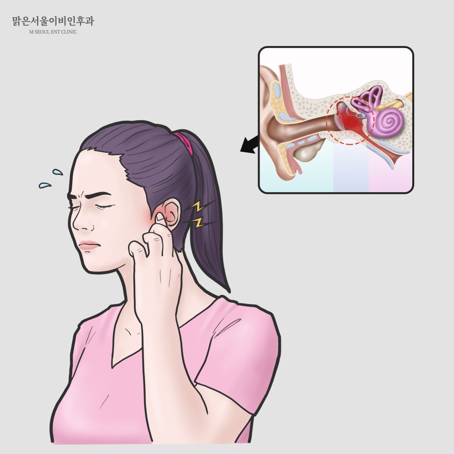 급성중이염 치료방법은 [노원이비인후과]