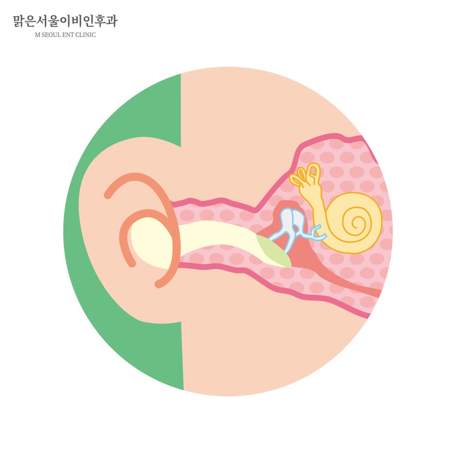 급성중이염 치료방법은 [노원이비인후과]