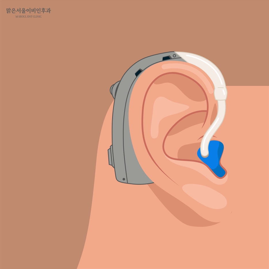 보청기 장점은? [노원구이비인후과]
