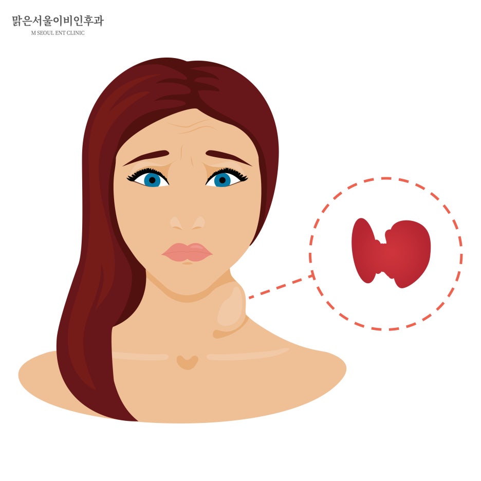 성대질환의 종류는 어떤것들이 있을까 [민락동이비인후과]