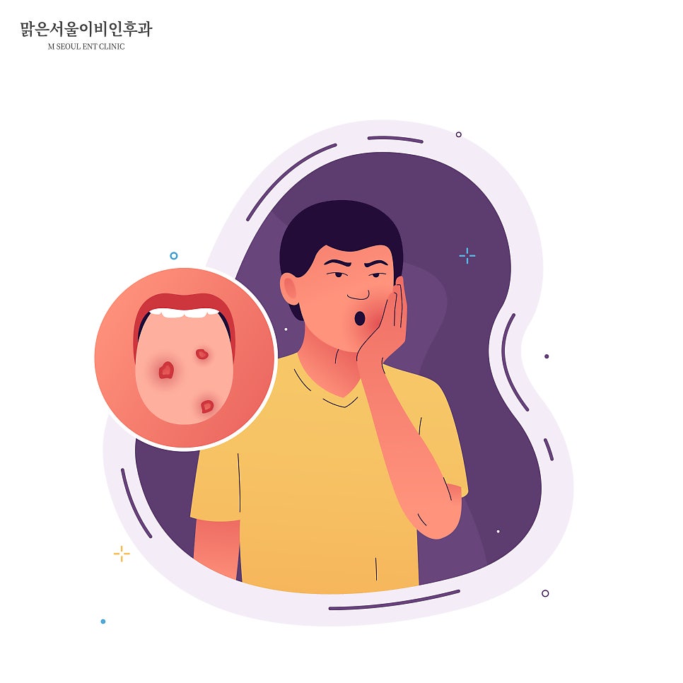구내염 치료하려면? [노원이비인후과]
