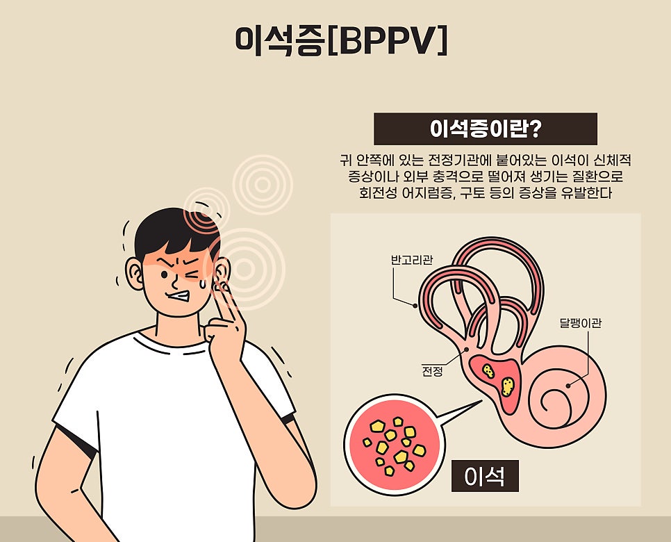 의정부 어지럼증 원인은 귀에 있습니다. 이석증, 메니에르병, 전정신경염