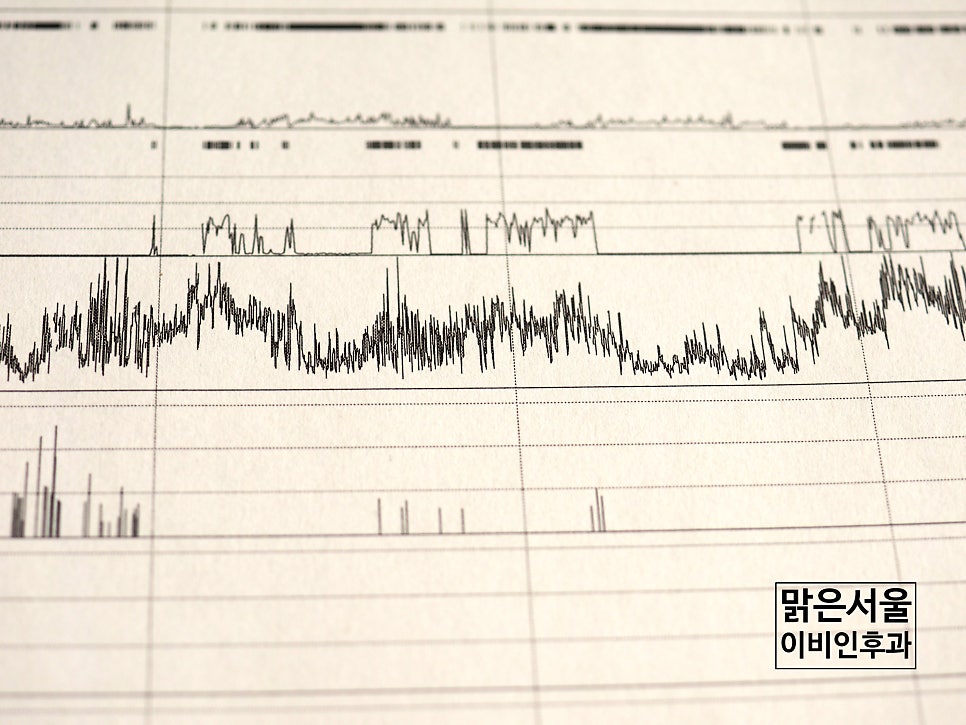 수면무호흡증의 위험성 [의정부수면다원검사][의정부이비인후과]