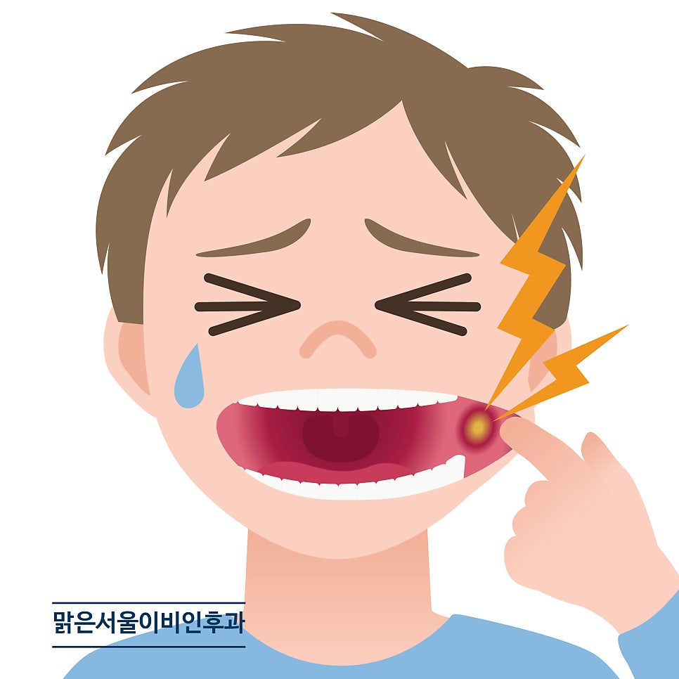 구내염은 어떻게 치료해야 할까요? [포천이비인후과]