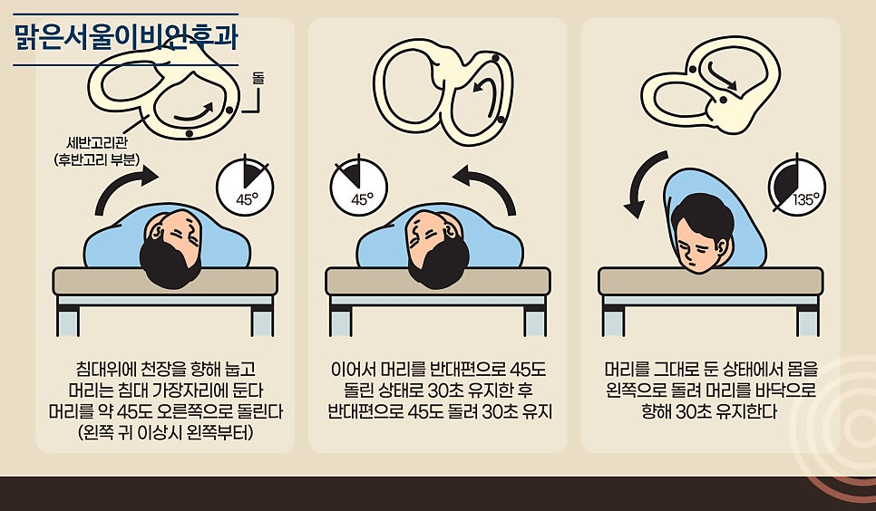 이석치환술은 어떻게 치료할까? [민락동이비인후과]