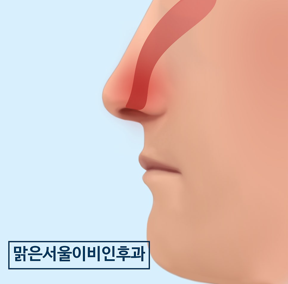 가을철 코가 건조하지 않도록 주의해 주세요 [남양주이비인후과]