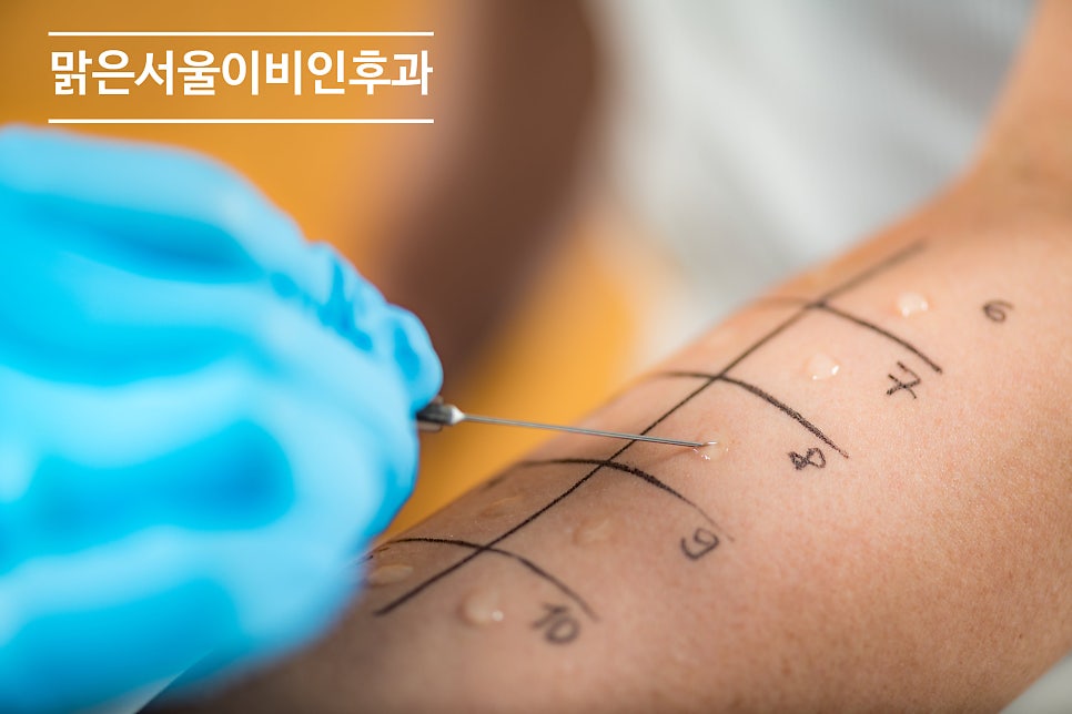 알레르기 검사 어떻게 진행할까요? [하남이비인후과]