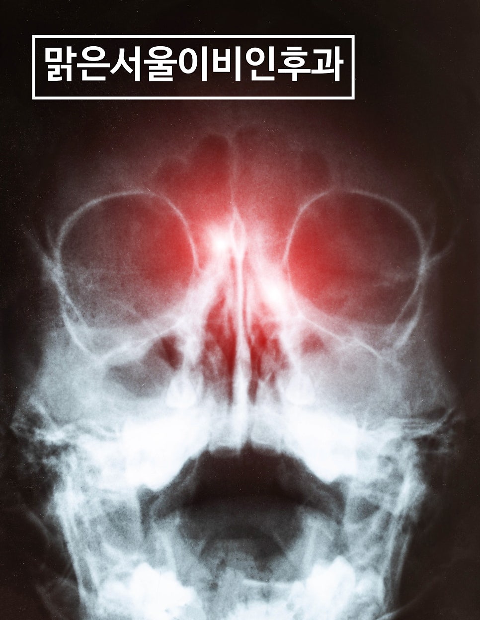 일교차가 큰 환절기에는 부비동염에 주의해주세요 [의정부이비인후과]
