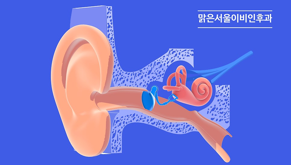 외이도염이 청력에 미치는 영향은? [노원이비인후과]