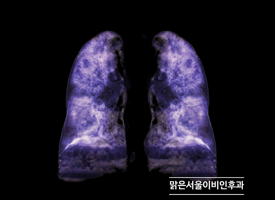 실내 공기질을 관리해야 호흡기 질환 예방! [노원이비인후과]