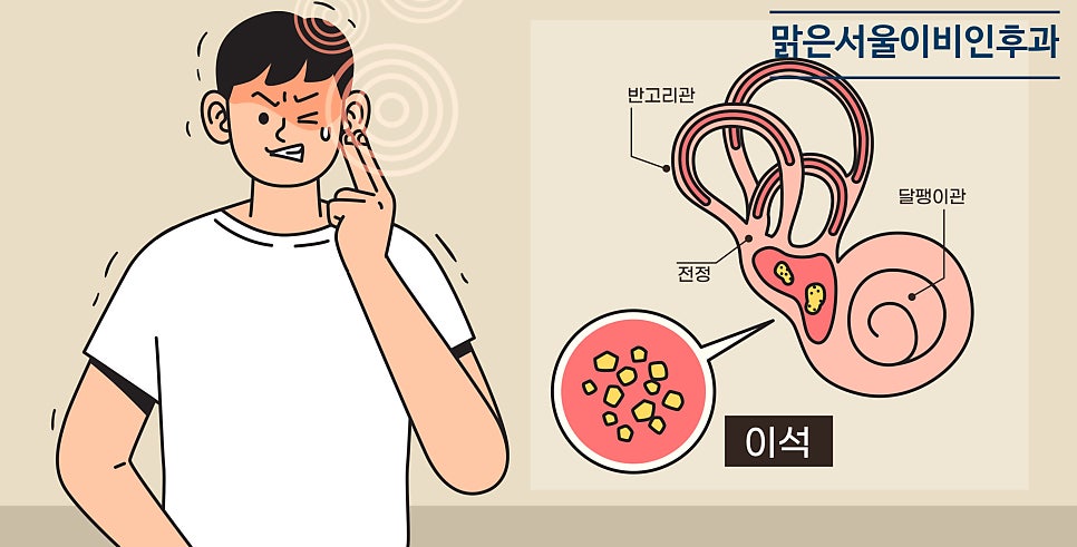 겨울철에는 이석증 발생 확률 높아집니다 [의정부 이석증]