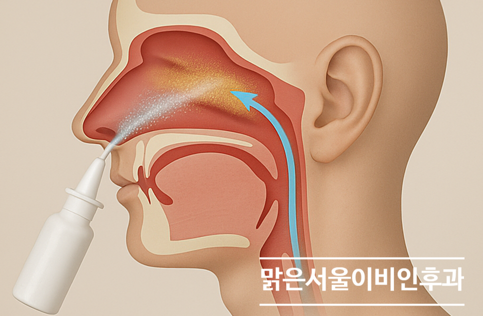 [별내이비인후과] 코가 막힐 때 나잘스프레이를 쓰시나요?