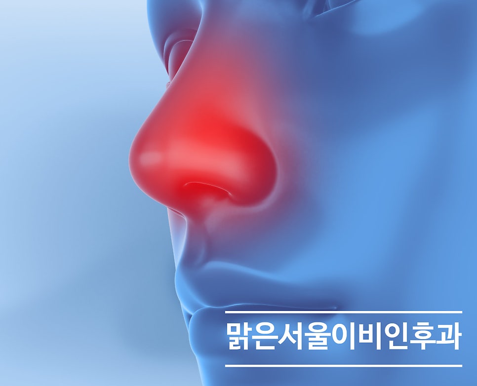 [의정부 축농증 수술] 축농증이 봄철에 더 심해지는 이유는?