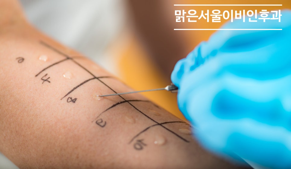 [의정부 햇빛알레르기] 외출만 하면 간지러우신가요? 햇빛알레르기 일 수도 있습니다