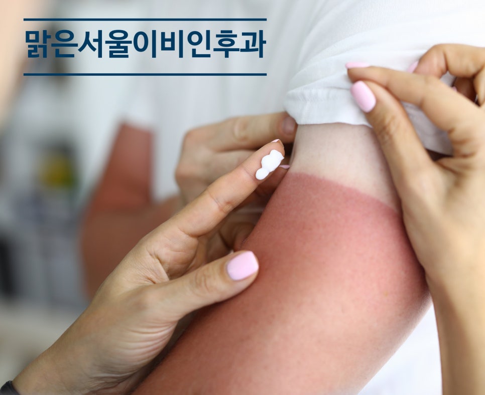 [의정부 햇빛알레르기] 외출만 하면 간지러우신가요? 햇빛알레르기 일 수도 있습니다