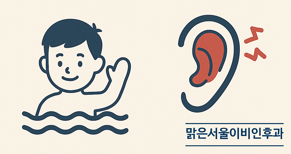 [양주이비인후과] 물놀이 후 세균감염, 여름철 외이도염
