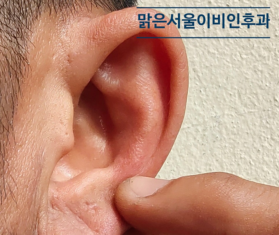 [의정부외이도염] 귀를 항상 깨끗하고 뽀송하게 유지해 주세요