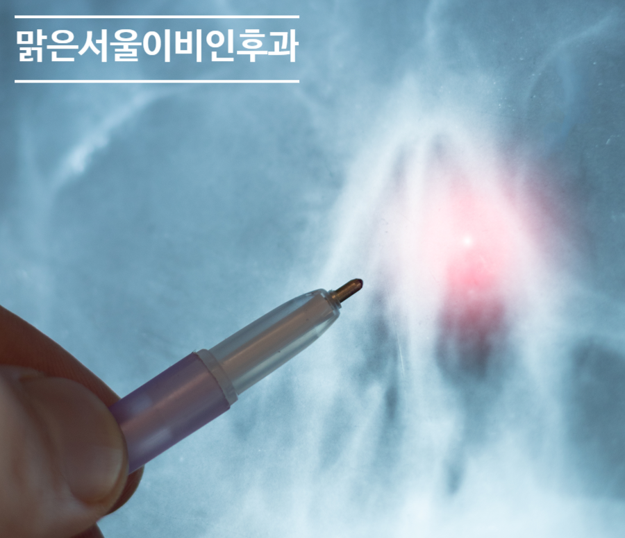 [포천이비인후과] 코골이는 수술로만 치료하나요?