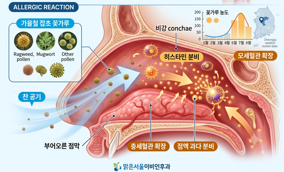 [양주이비인후과] 아침마다 콧물·재채기 심하다면? 가을 알레르기 비염 검사 및 치료