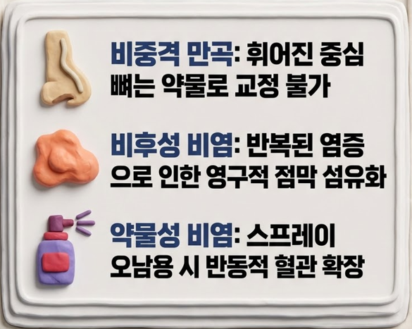[남양주이비인후과] 비염약 먹어도 코막힘 안 풀린다면, 수술까지 고려해야 할 때